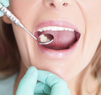 Periodoncia